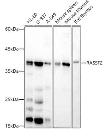 RASSF2 Rabbit Monoclonal Antibody