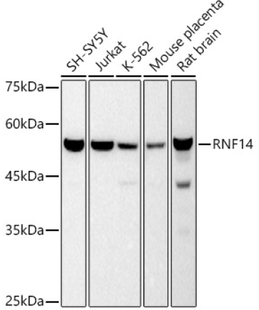 RNF14 Rabbit Monoclonal Antibody