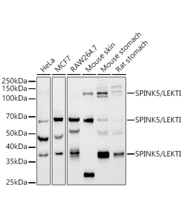 SPINK5 / LEKTI Rabbit Monoclonal Antibody