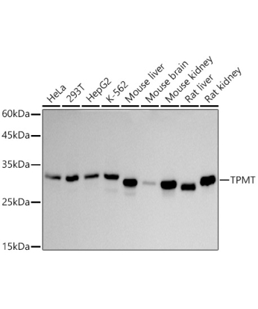 TPMT Rabbit Monoclonal Antibody