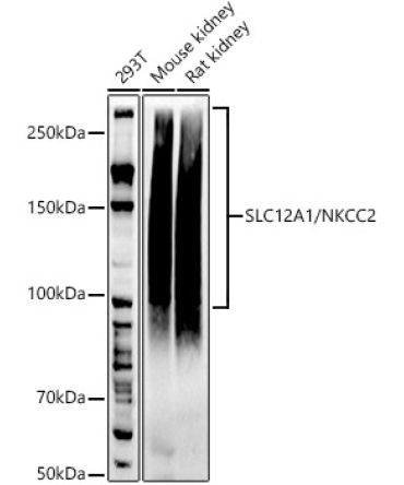 SLC12A1 / NKCC2 Rabbit Monoclonal Antibody