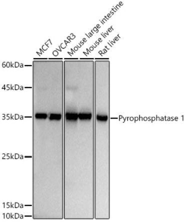 Pyrophosphatase 1 Rabbit Monoclonal Antibody