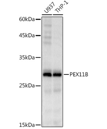 PEX11B Rabbit Monoclonal Antibody