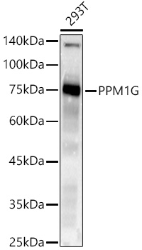 PPM1G Rabbit Monoclonal Antibody