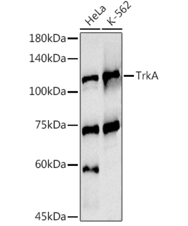 TrkA Rabbit Polyclonal Antibody