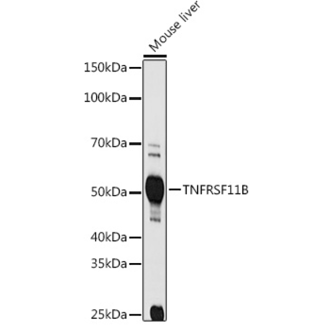 TNFRSF11B Rabbit Polyclonal Antibody