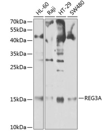 REG3A Rabbit Polyclonal Antibody