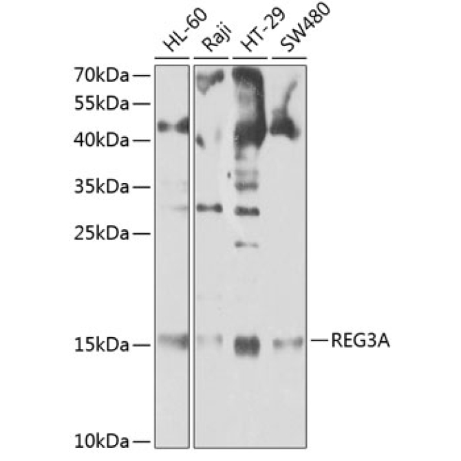 REG3A Rabbit Polyclonal Antibody