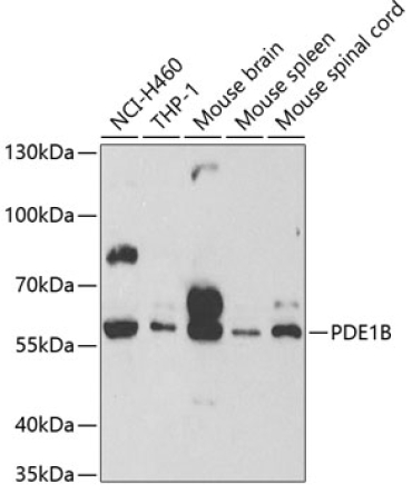 PDE1B Rabbit Polyclonal Antibody
