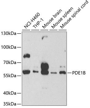PDE1B Rabbit Polyclonal Antibody