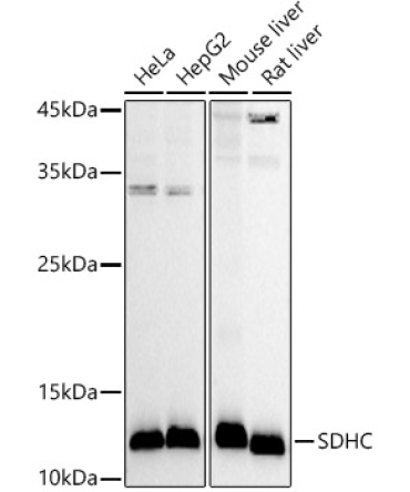 SDHC Rabbit Polyclonal Antibody