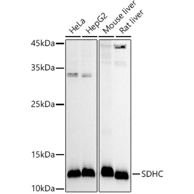 SDHC Rabbit Polyclonal Antibody