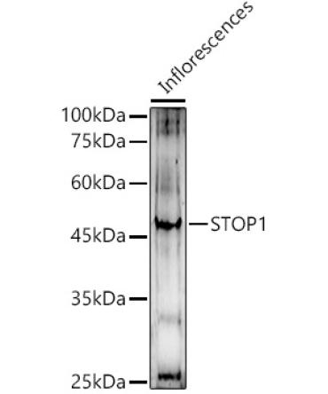 STOP1 Rabbit Polyclonal Antibody
