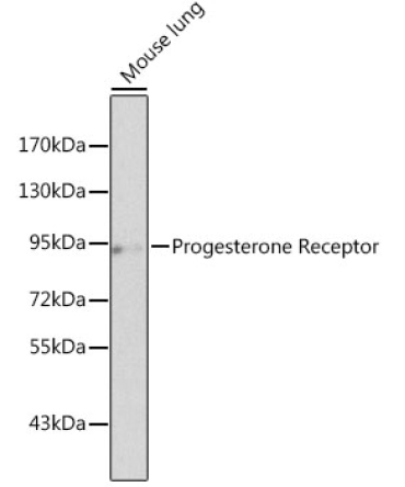 Progesterone Receptor Rabbit Polyclonal Antibody