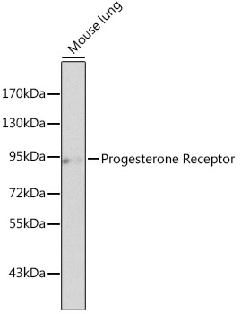 Progesterone Receptor Rabbit Polyclonal Antibody