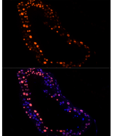 RBMXL2 Rabbit Monoclonal Antibody