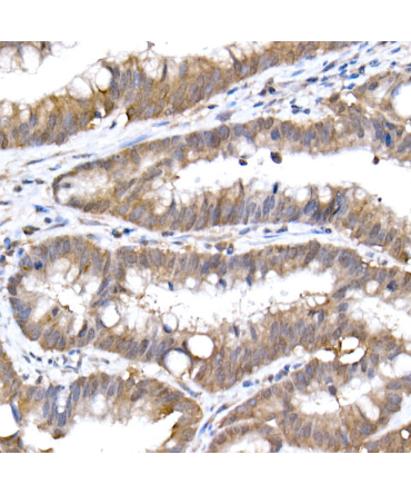 SFT Rabbit Monoclonal Antibody