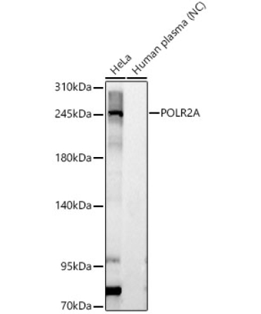 POLR2A Rabbit Polyclonal Antibody