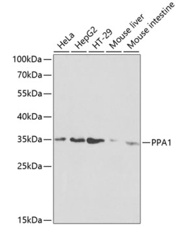 PPA1 Rabbit Polyclonal Antibody