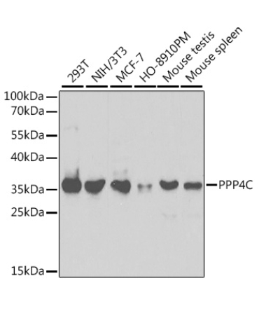 PPP4C Rabbit Polyclonal Antibody