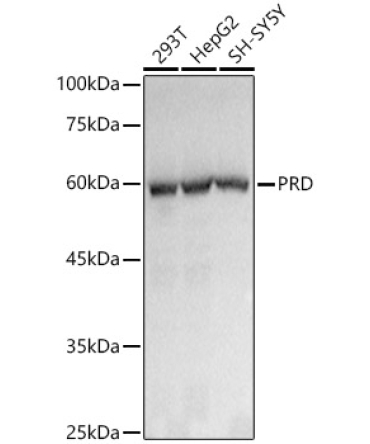 PRD Rabbit Monoclonal Antibody