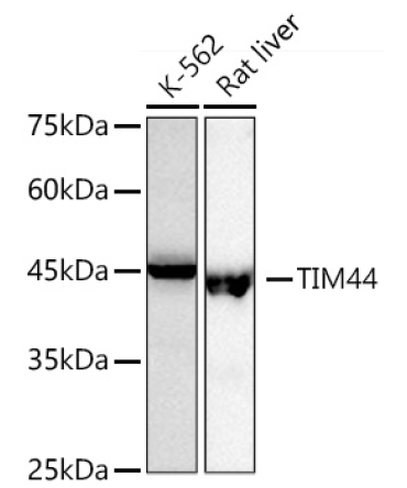 TIM44 Rabbit Monoclonal Antibody