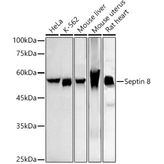 Septin 8 Rabbit Monoclonal Antibody