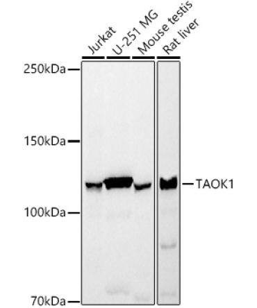 TAOK1 Rabbit Monoclonal Antibody