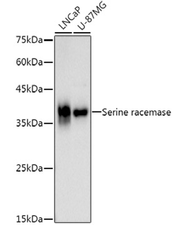 Serine racemase Rabbit Monoclonal Antibody