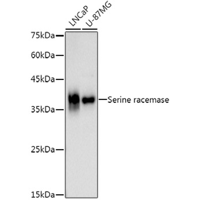 Serine racemase Rabbit Monoclonal Antibody