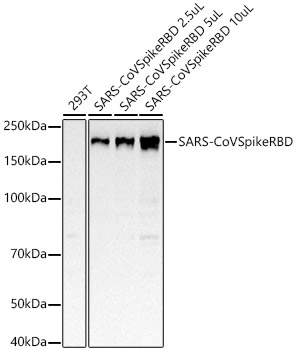 SARS-CoV Spike RBD Rabbit Monoclonal Antibody