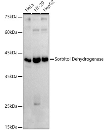 Sorbitol Dehydrogenase Rabbit Polyclonal Antibody