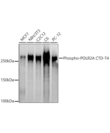 Phospho-POLR2A CTD-T4 Rabbit Polyclonal Antibody