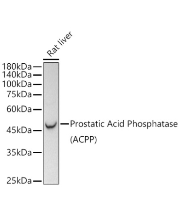 Prostatic Acid Phosphatase (PSAP)  Rabbit Monoclonal Antibody