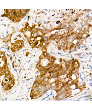 SOD1 Rabbit Monoclonal Antibody