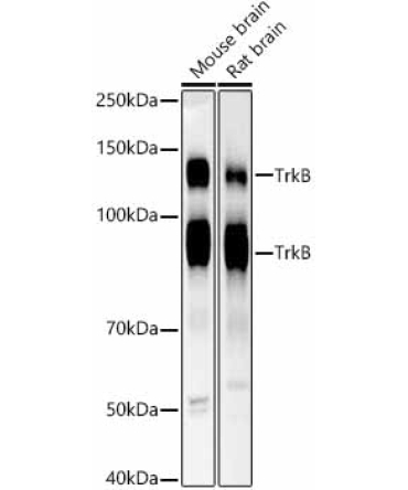 TrkB Rabbit Monoclonal Antibody