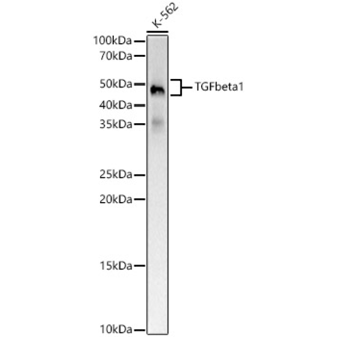 TGF beta 1 Rabbit Monoclonal Antibody