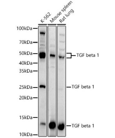 TGF beta 1 Rabbit Polyclonal Antibody