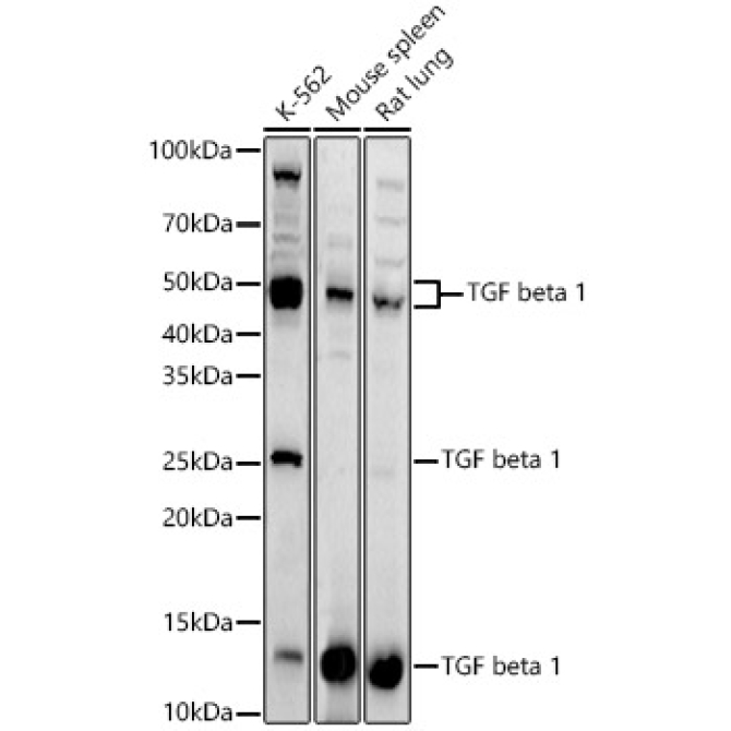 TGF beta 1 Rabbit Polyclonal Antibody