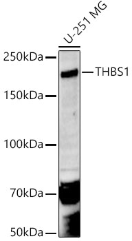THBS1 Rabbit Polyclonal Antibody