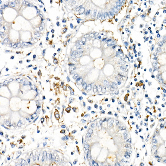 TNF-Alpha Rabbit Monoclonal Antibody