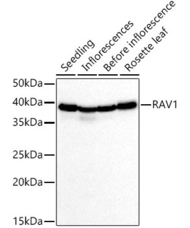 RAV1 Rabbit Polyclonal Antibody