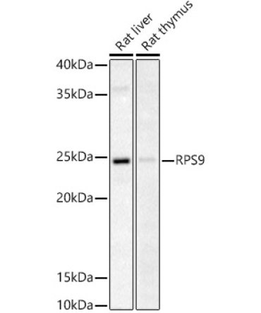 RPS9 Rabbit Polyclonal Antibody