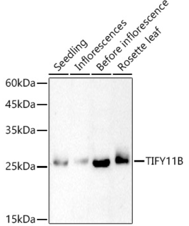 TIFY11B Rabbit Polyclonal Antibody