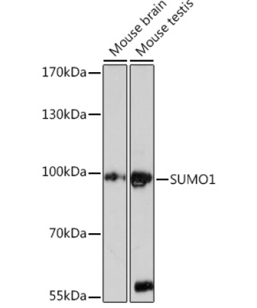 SUMO1 Rabbit Polyclonal Antibody