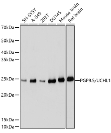 PGP9.5/UCHL1 Rabbit Polyclonal Antibody
