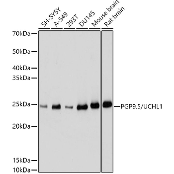 PGP9.5/UCHL1 Rabbit Polyclonal Antibody