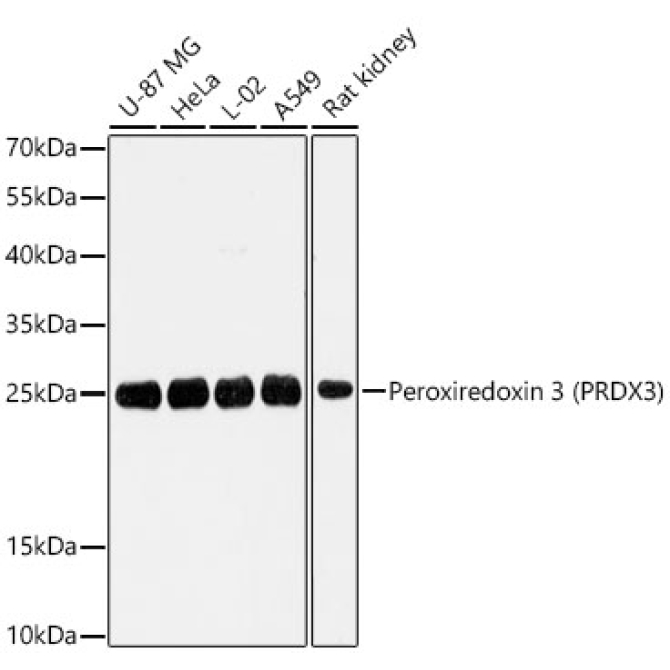 Peroxiredoxin 3 (PRDX3) Rabbit Polyclonal Antibody