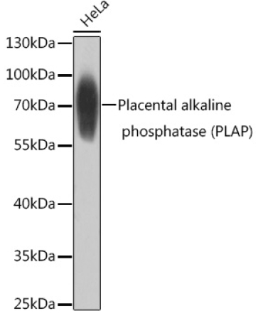 Placental alkaline phosphatase (PLAP) Rabbit Polyclonal Antibody