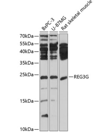REG3G Rabbit Polyclonal Antibody